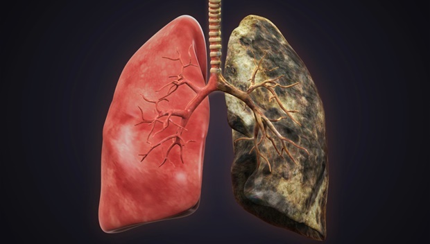 dohányos és egészséges tüdő